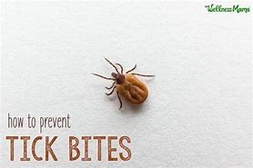 Image result for Treating Tick Bites