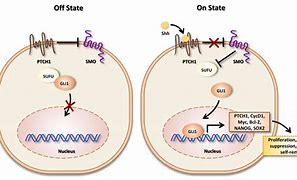 Image result for Shh Pathway Medulloblastoma