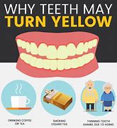 Image result for Teeth with Yellow Stuff