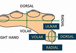 Image result for Volar Aspect Finger