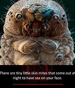 Image result for Itch Mites On Face