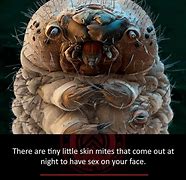 Image result for Skin Mites On Humans