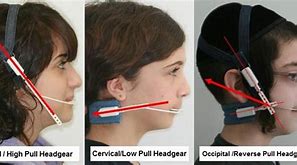 Image result for Full Orthodontic Headgear