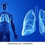 Image result for Lungs of a Person with Asthma