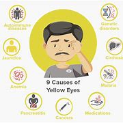 Image result for Eye Nut Yellow