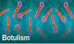 Image result for Botulism