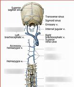 Image result for Venous Plexus Spine