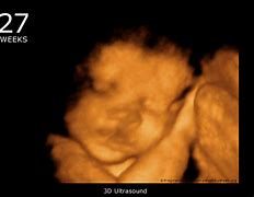 Image result for 4D Ultrasound at 15 Weeks