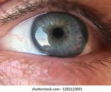 Image result for Human Eyeball Close Up