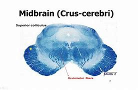 Image result for Brain Tissue Histology