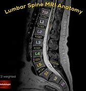 Image result for Lumbar and Sacral Spine