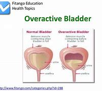 Image result for Overactive Bladder Surgery