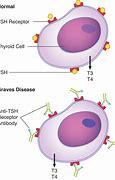 Image result for TSH Receptor Antibodies