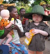 Image result for South African Albino Child