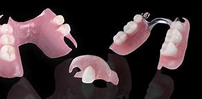 Image result for Metal-Based Partial Dentures