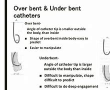 Image result for Coronary Angiography Catheters