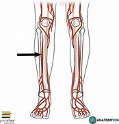 Image result for A Tibialis Ant