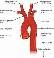 Image result for Aortic Vessels