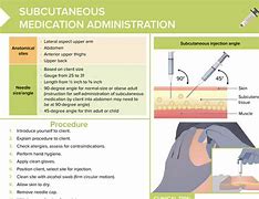 Image result for Subcutaneous Injection