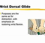 Image result for Dorsalgia Aguda