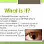 Image result for Cat Eye Syndrome