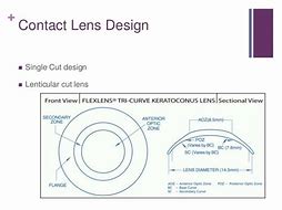 Image result for Contact Lens Design Book