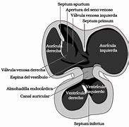 Image result for Septum Secundum