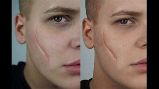 Image result for Facial Scar Makeup