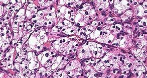 Image result for Repolyo Tissue