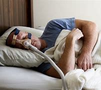 Image result for Obstructive Sleep Apnea and Hypertension