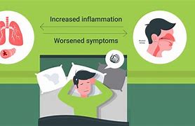 Image result for Sleep Apnea and Asthma