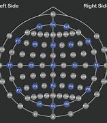 Image result for tDCS Placement Map