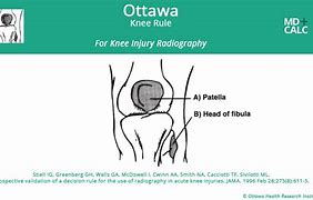 Image result for Ottawa Knee