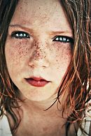 Image result for Ace Freckles