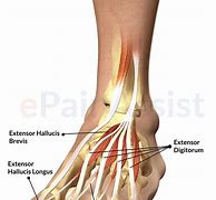 Image result for Extensor Digitorum Foot Pain