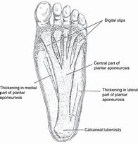 Image result for Mechanics of Plantar Fascia