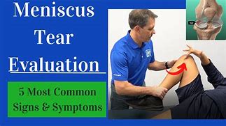 Image result for Tear of Meniscus