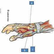 Image result for Extensor Pollicis Long Sensor Pinch