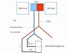 Image result for Nonphasic Venous Flow