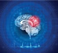 Image result for Concussion Mindset