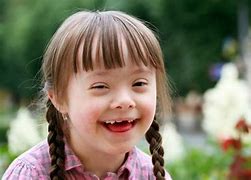 Image result for Down Syndrome Baby Pictures