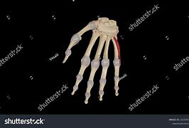 Image result for M Flexor Digiti Minimi Brevis