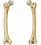 Image result for Femur Parts