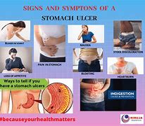 Image result for 10 Signs of a Stomach Ulcer