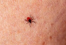 Image result for Bug Bites and Stings