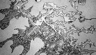 Image result for Grief Tears Under Microscope