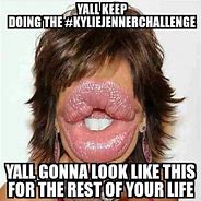 Image result for Lip Injection Memes