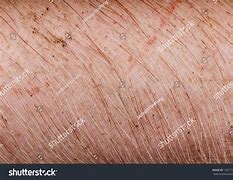 Image result for Pig Skin Conditions