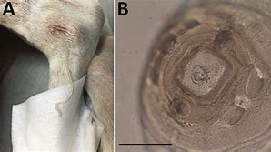 Image result for Dracunculus Nematode