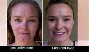 Image result for Proactiv Cleansening Brush Open